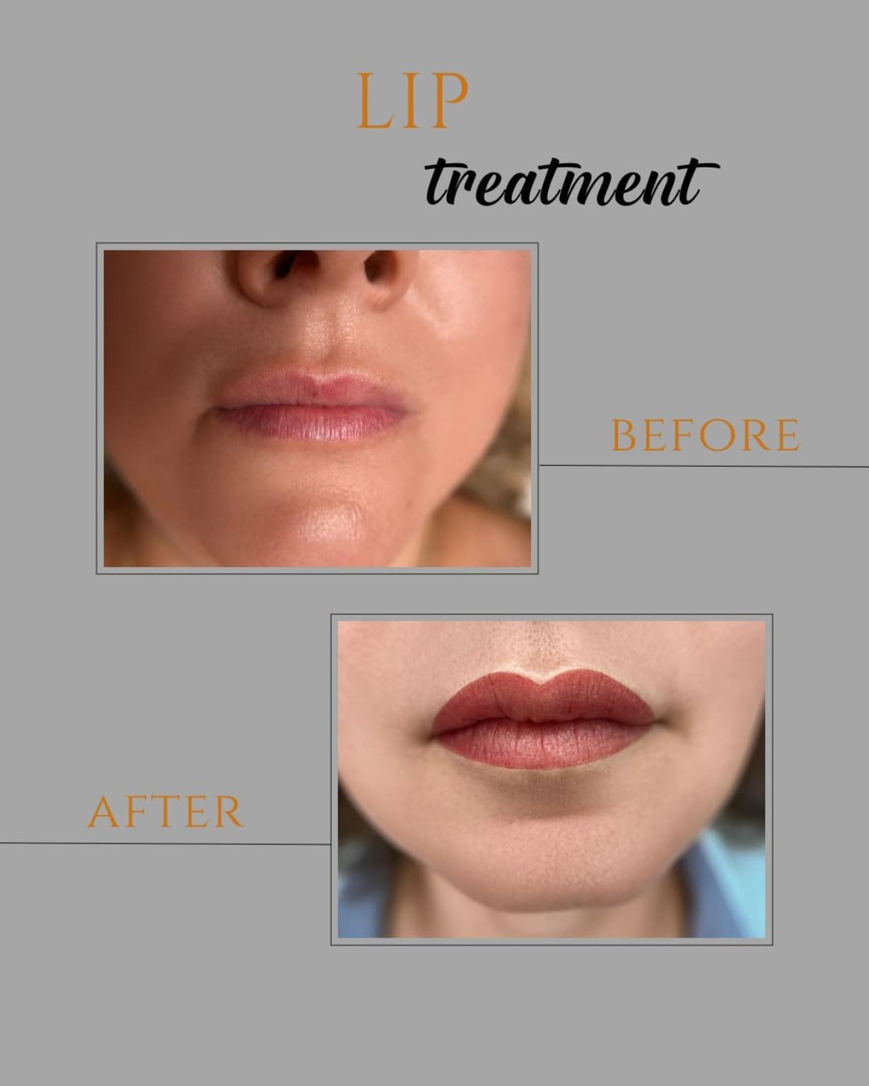 Vorher-Nachher-Vergleich einer Permanent-Make-up-Lippenbehandlung